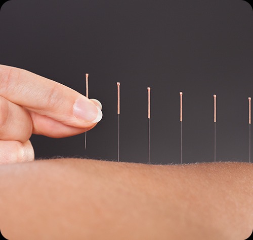 TCM/Acupuncture