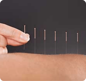 TCM / Acupuncture